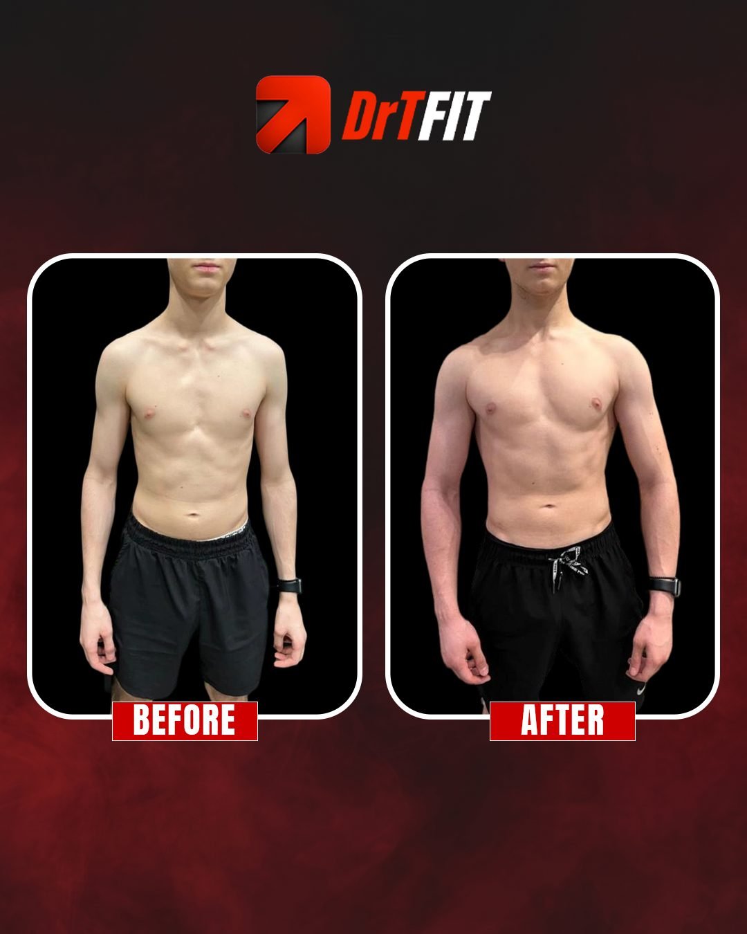 نتيجة تحول الجسم قبل وبعد مع DrTFit — حالة 2