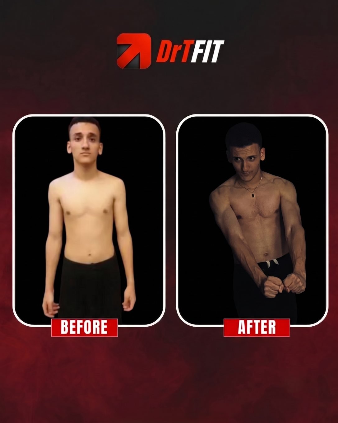 نتيجة تحول الجسم قبل وبعد مع DrTFit — حالة 4