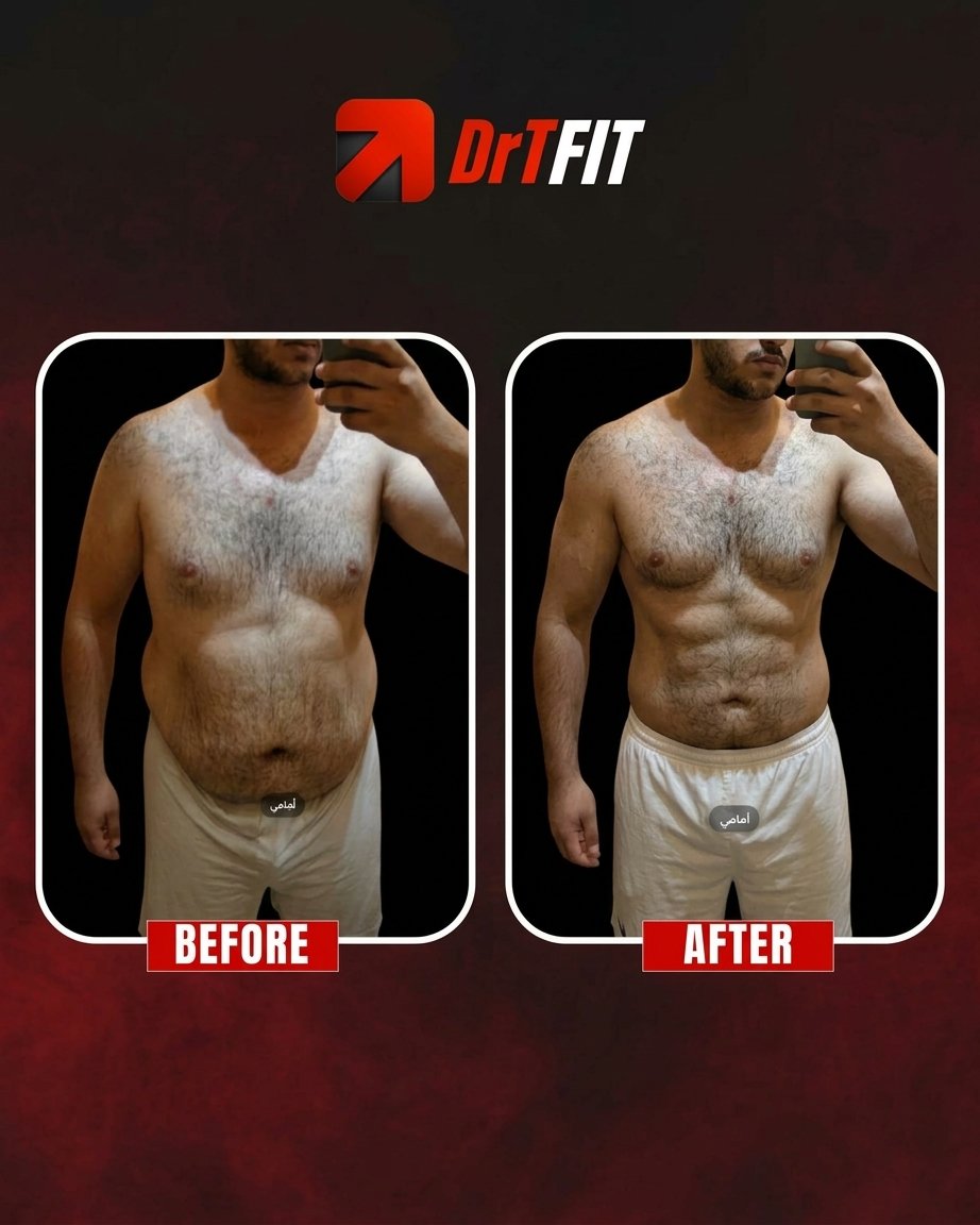 نتيجة تحول الجسم قبل وبعد مع DrTFit — التخلص من دهون البطن (أمامي)