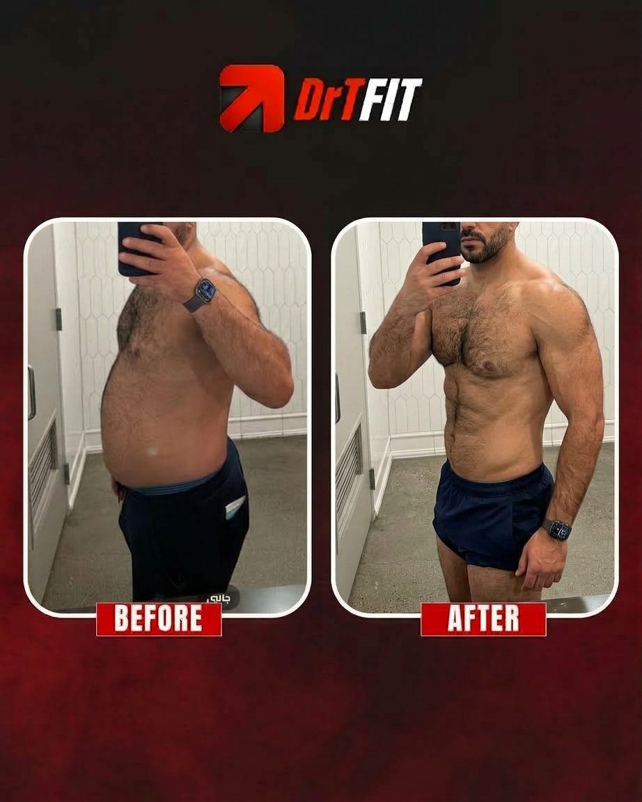 نتيجة تحول الجسم قبل وبعد مع DrTFit — شد ونحت الجسم (جانبي)
