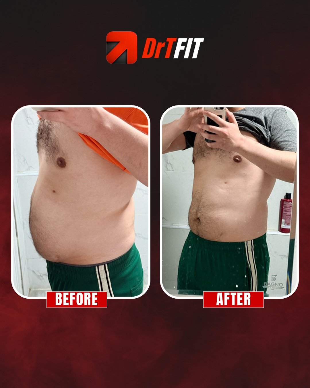 نتيجة تحول الجسم قبل وبعد مع DrTFit — حالة 5