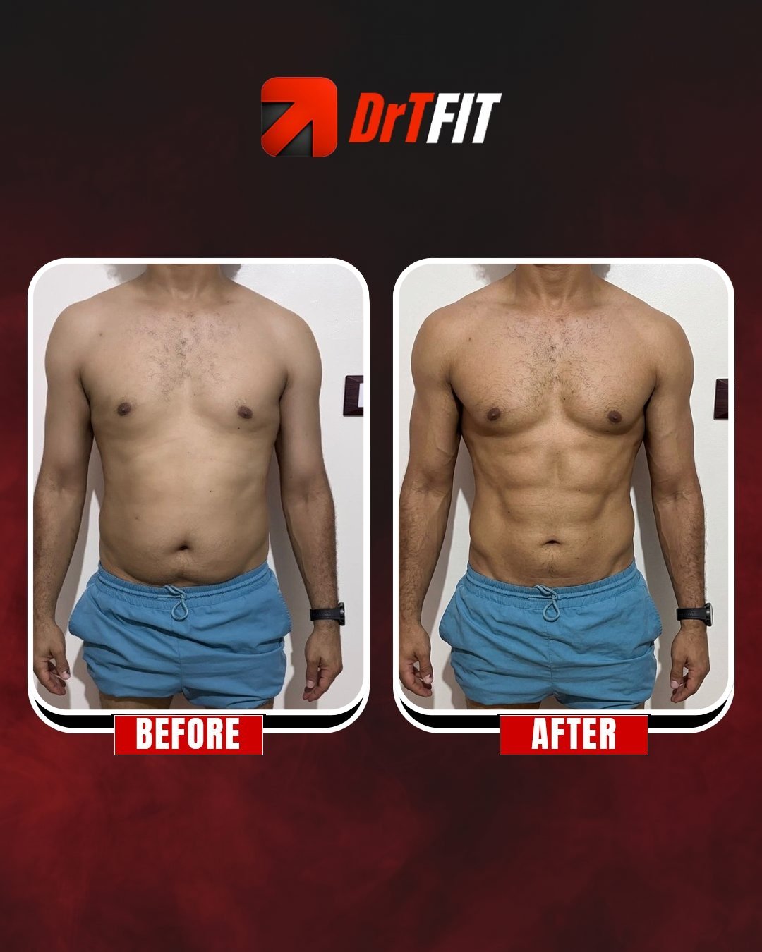 نتيجة تحول الجسم قبل وبعد مع DrTFit — نحت وتقسيم عضلات البطن
